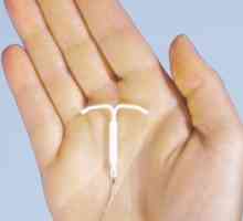 IUD kao metode kontracepcije