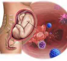 Intrauterine infekcije u trudnoći i novorođenčadi