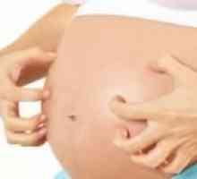 Svrab u trudnoći