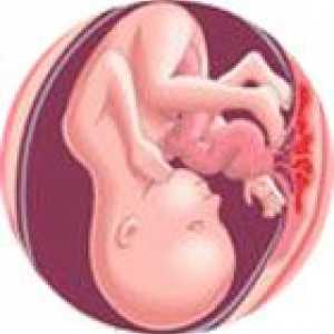 18 Tjedana trudnoće
