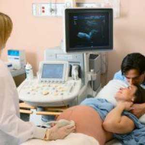 24 Tjedna trudnoće