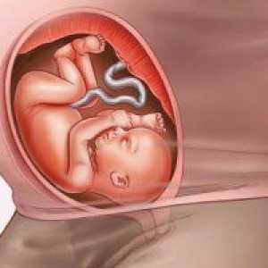 34 Tjedna trudnoće: Fetalni veličine