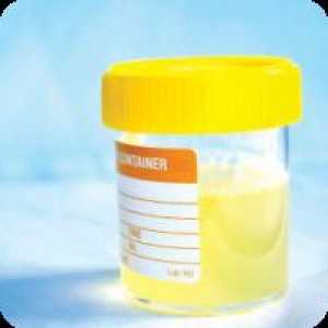 Aceton u urinu tijekom trudnoće