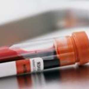Test krvi za hormone