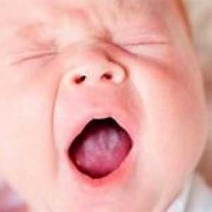 Ono što treba da znate o novorođenčeta usta?