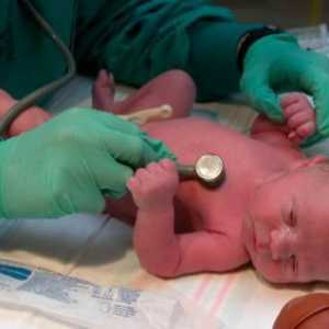 Ono što je gušenje u novorođenčadi i kako ga liječiti
