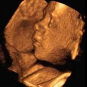 Razvoj i težine djeteta na dan 31. tjedna trudnoće