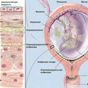 Kako izliječiti mikoplazmoze u trudnoći