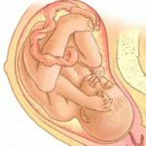 Kako je beba u utrobi. Kako odrediti položaj fetusa