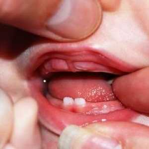 Kako rastu zubi kod djece?