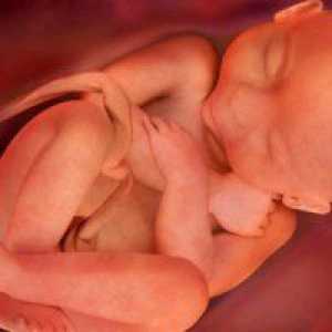 Koliki fetus na 25 tjedna trudnoće