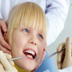 Tretman mliječnih zuba