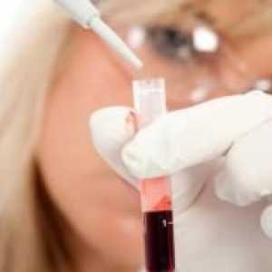 Bijelih krvnih stanica - norma kod djece
