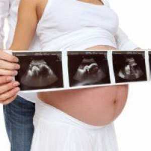 Oligohidramnion u trudnoći: 34 tjedna