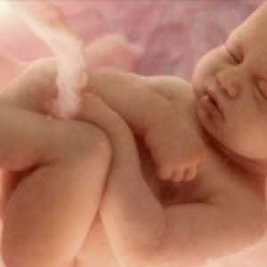 Normalno fetusa veličina na 32 tjedana trudnoće