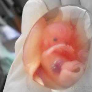 Plod je 10 sedmica trudna, 10 tjedana trudnoće - fetusa veličina