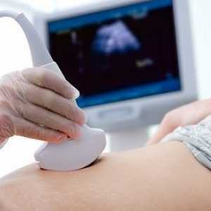 Prenatalni screening
