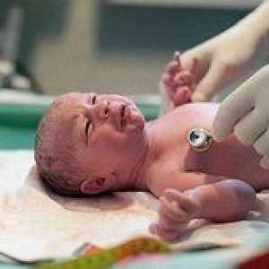 Uzroka i posljedica hipoksije u novorođenčeta