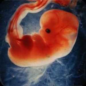 Razlozi za trudnoću u razvoju