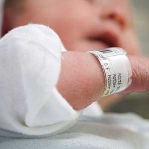 Uzroci ljuštenje kože kod novorođenčadi i kako riješiti problem