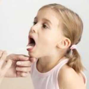 Simptomi angine kod djeteta