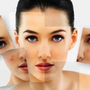 Problem kože: 7 popularne zablude o aknama