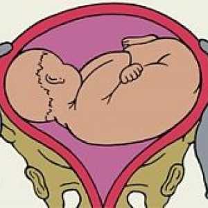 Uzdužni položaj fetusa