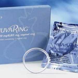 NuvaRing kontraceptiv