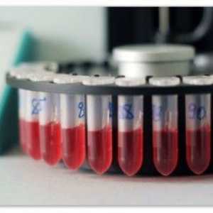 Dešifrovanje rezultate testa krvi u djece