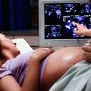 Otkucaj srca fetusa tokom trudnoće