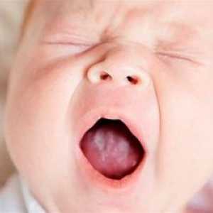 Stomatitis u novorođenčadi: simptomi, liječenje