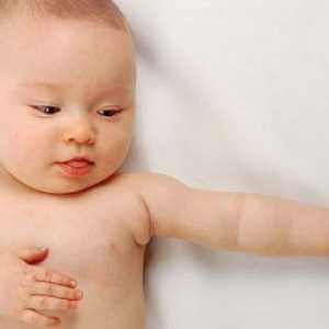 Suha koža u novorođenčadi i novorođenčadi