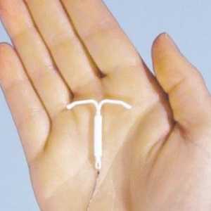 IUD kao metode kontracepcije