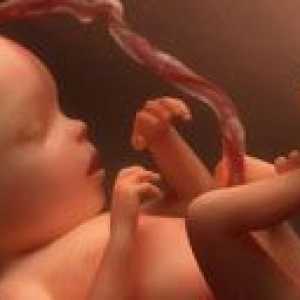 Kongenitalne malformacije fetusa